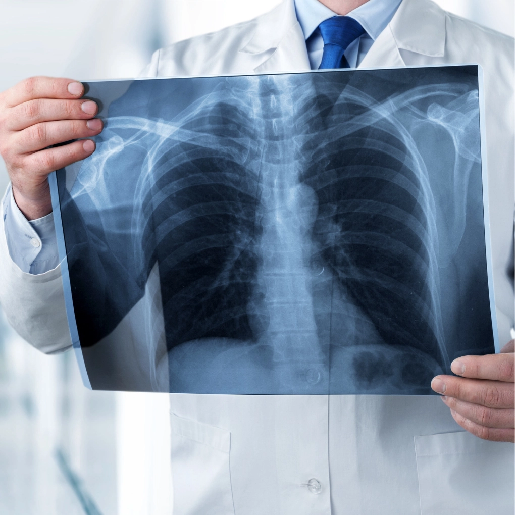 A doctor wearing a white coat and a stethoscope is looking at a chest X-ray.
