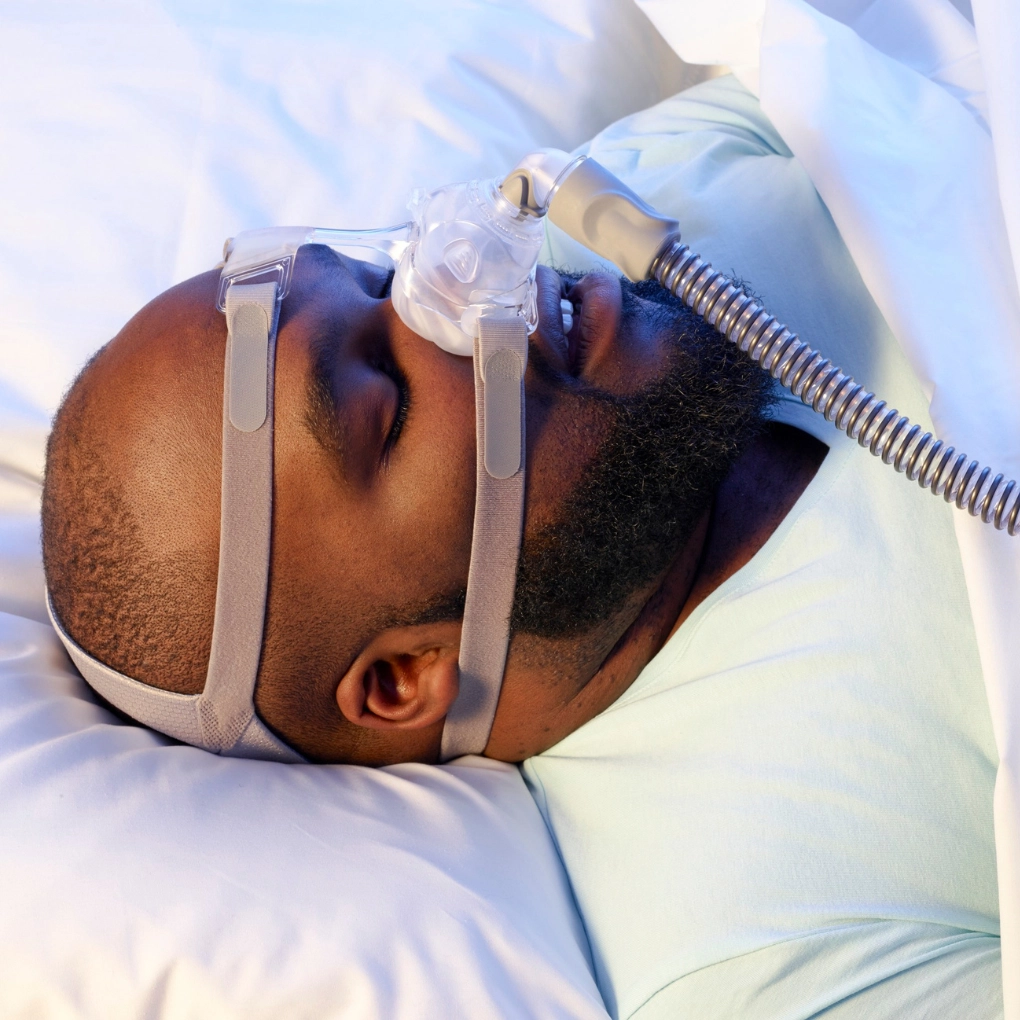 Sleep apnea is a sleep disorder that causes people to stop breathing repeatedly during sleep.